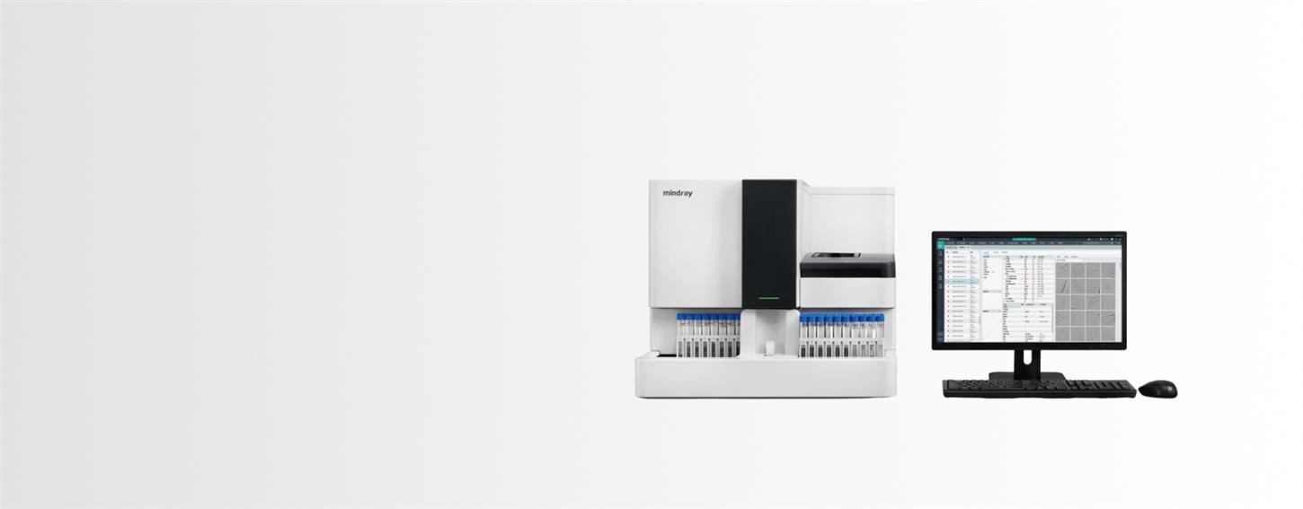 Otomatik İdrar Analizi Sistemi