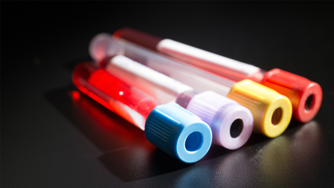 BD Vacutainer Citrate Tubes